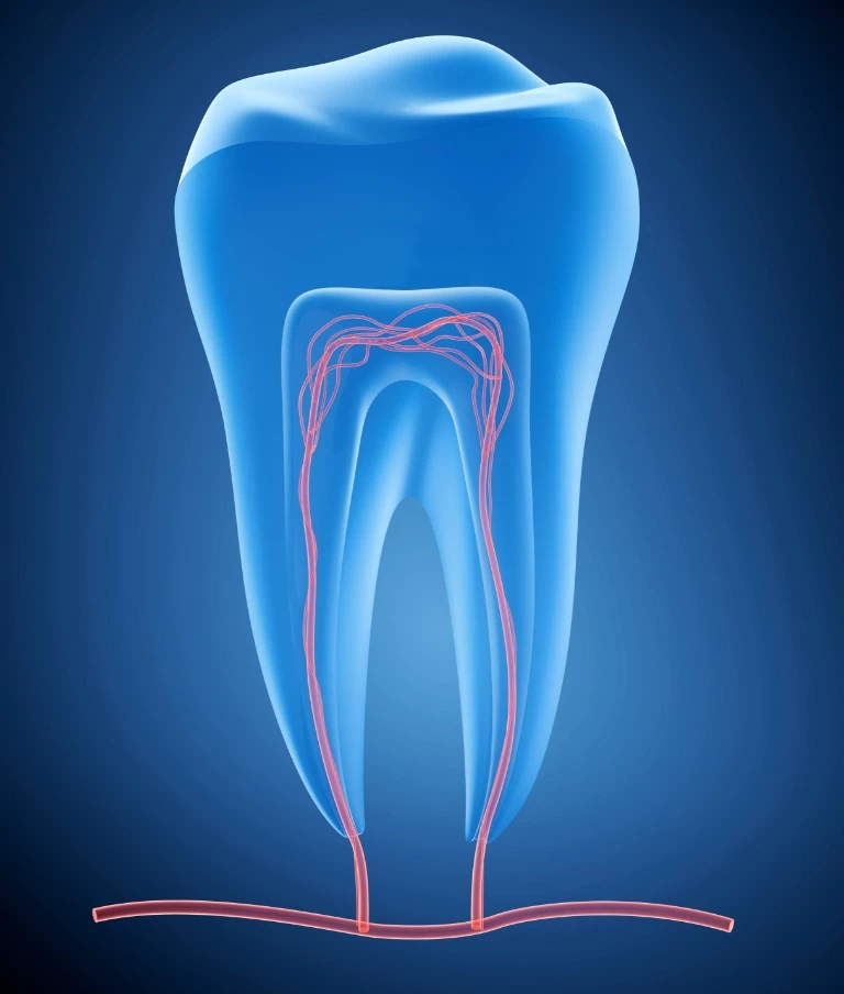 urządzenie do endodoncji